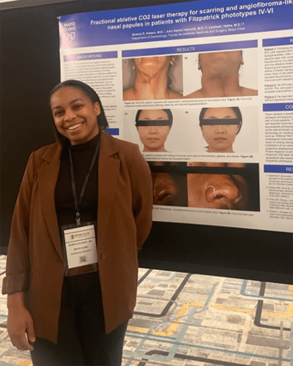 A Dermatology resident attending and presenting research at the Skin of Color.