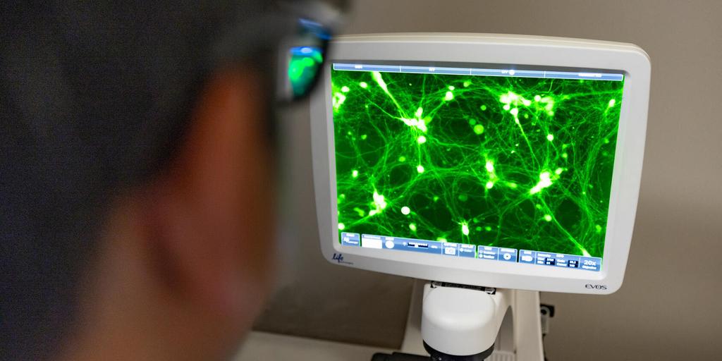 A clinica neurology fellow examines a neurological image on a microscope screen at Mayo Clinic