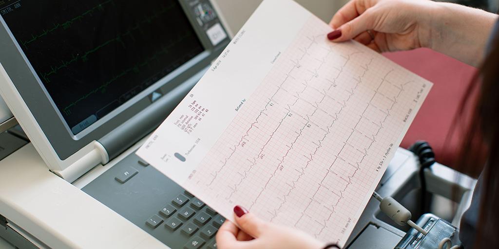 A close up photo of a cardiac monitoring assessment from a computer at Mayo Clinic