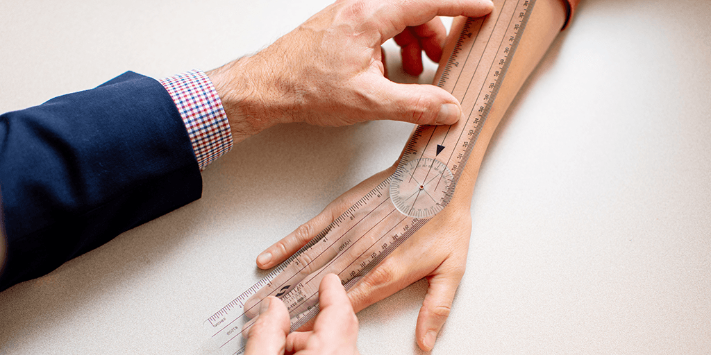 Fellow measuring a patient's forearm and hand