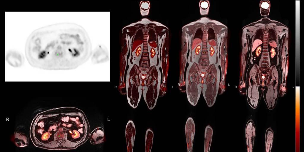 Scan of a patient by the Division of Nuclear Medicine