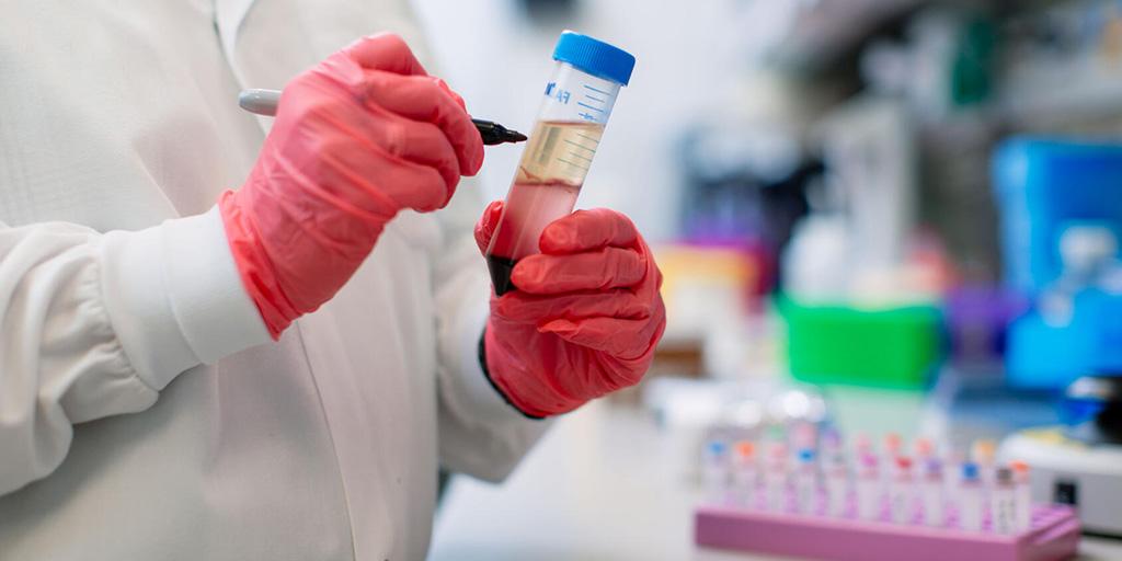 A pharmacist writes on a test tube in a lab at Mayo Clinic