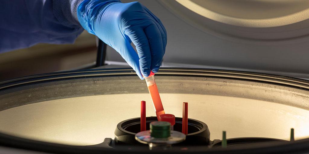 A hand picking up a vial in a lab at Mayo Clinic showing translational cardiovascular disease research at Mayo Clinic