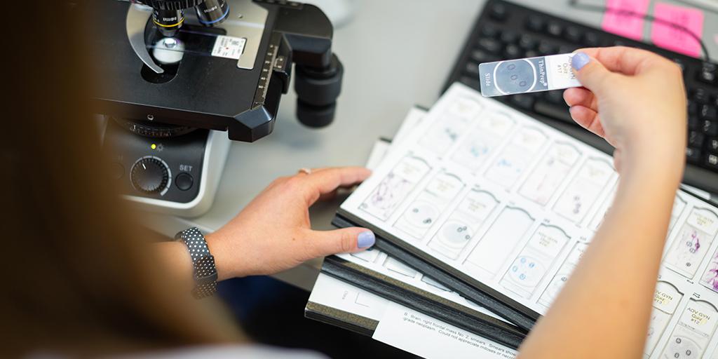 Close-up photo of someone examining microscope slide in the Cytotechnology Program.