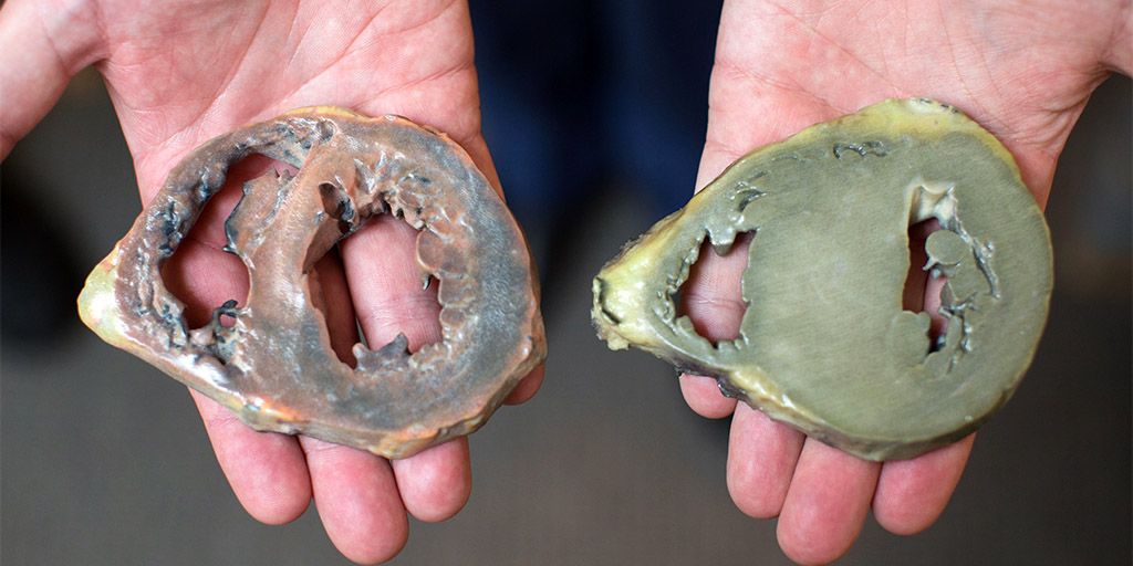 3D-printed specimen models that are routinely obtained in the a diagnostic examination of cardiovascular cases.