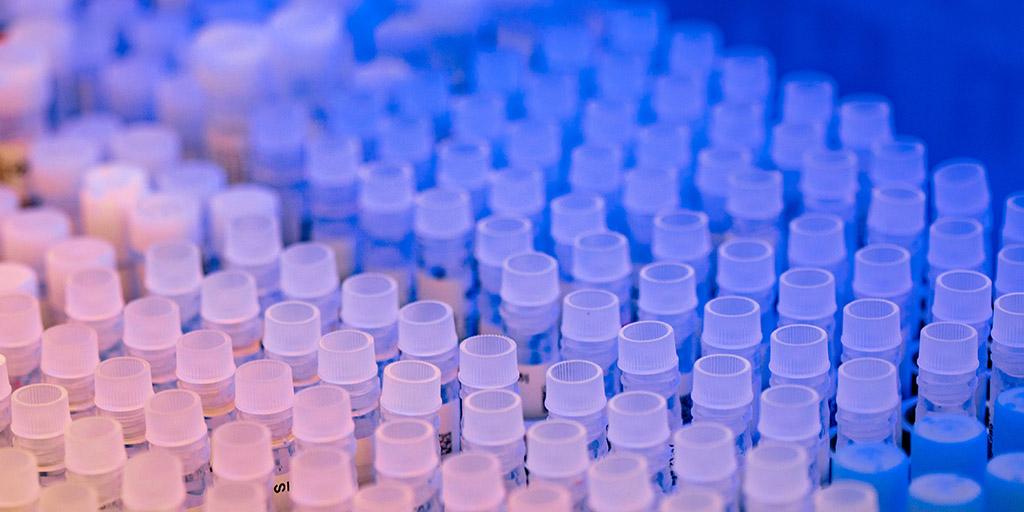 Test tubes in Mayo Clinic's Department of Laboratory Medicine and Pathology (DLMP)
