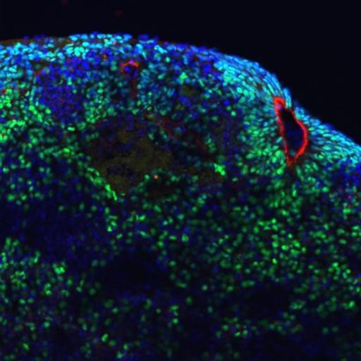 A confocal microscopy image of a brain organoid