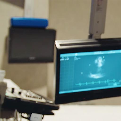 Echocardiography: Pushing yourself with support. 