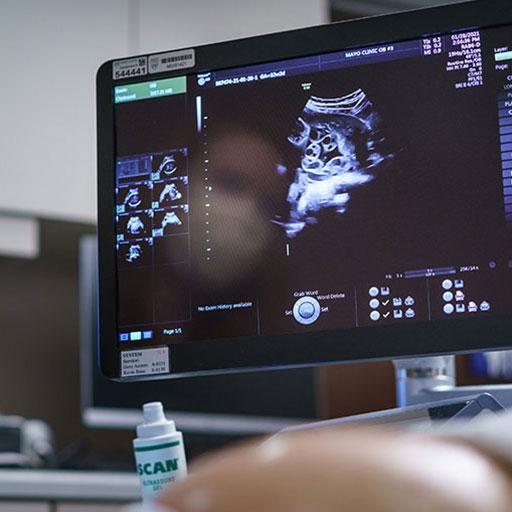 Ultrasound imaging from the obstetrics suite at Mayo Clinic in Minnesota