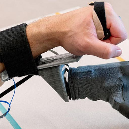 Program overview: Occupational Therapy Hand Fellowship