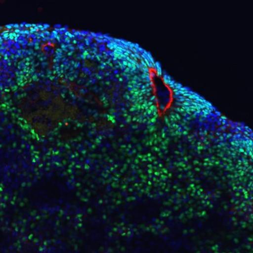 A confocal microscopy image of a brain organoid